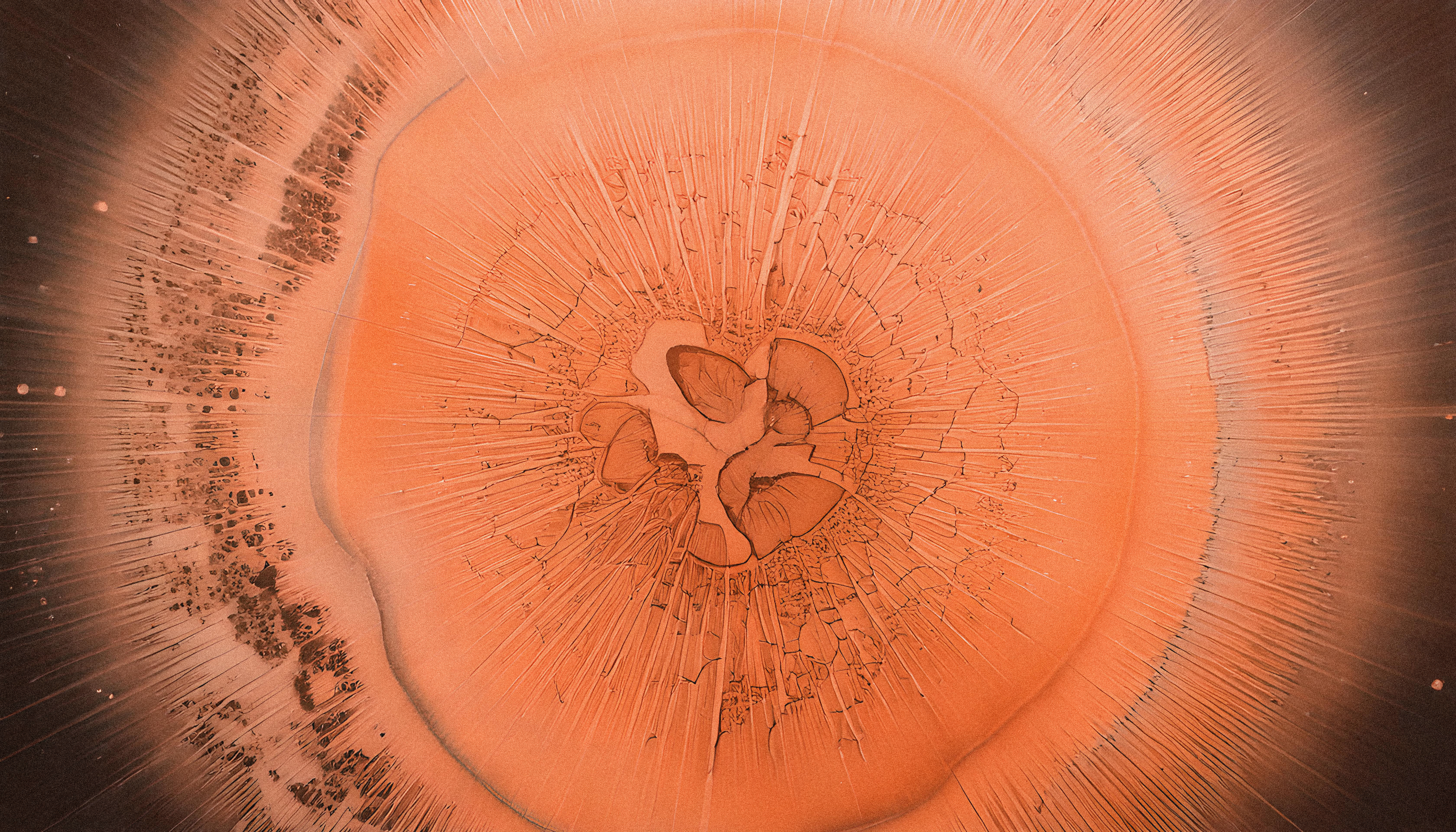 ESID2026: experts call for earlier diagnosis and greater awareness as SIDs continue to rise
